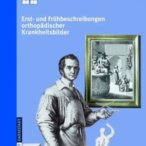 Today Only Erst- und Frühbeschreibungen orthopädischer Krankheitsbilder