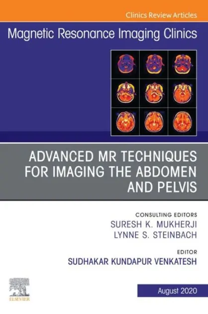 Sale Advanced MR Techniques for Imaging the Abdomen and Pelvis, An Issue of Magnetic Resonance Imaging Clinics of North America, E-Book: Advanced MR Techniques for Imaging the Abdomen and Pelvis, An Issue of Magnetic Resonance Imaging Clinics of North America,