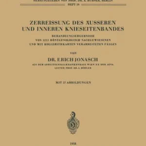 Zerreissung des ï¿½usseren und Inneren Knieseitenbandes: Behandlungsergebnisse von 1211 Rï¿½ntgenologisch Nachgewiesenen und mit Hollerithkarten Verarbeiteten Fï¿½llen Seasonal Sale