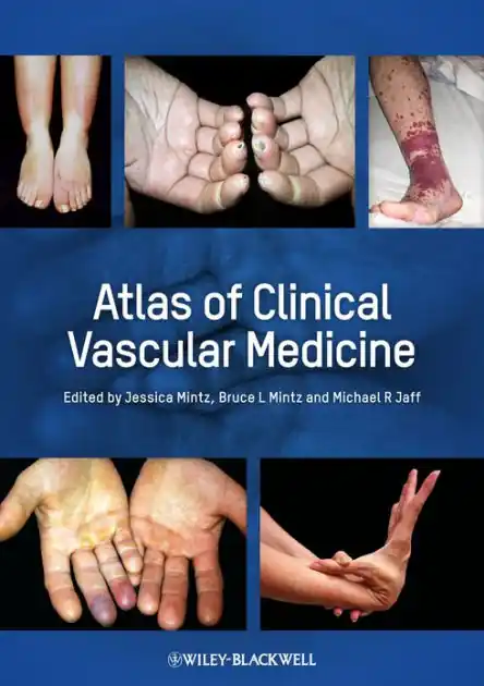 Hot Deal Atlas of Clinical Vascular Medicine