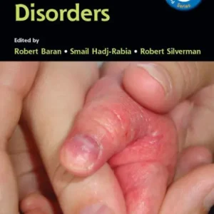 Pediatric Nail Disorders Big Sale