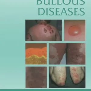 Time-Limited Atlas of Bullous Diseases